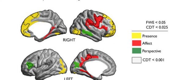 Brain