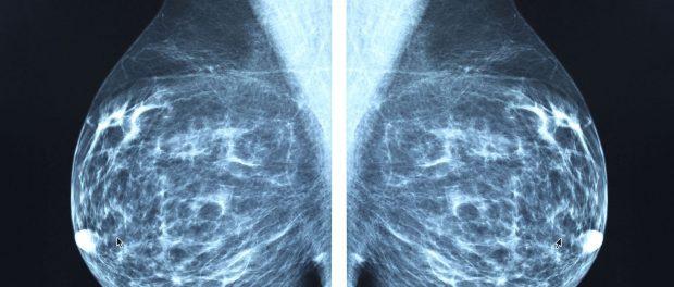 xray